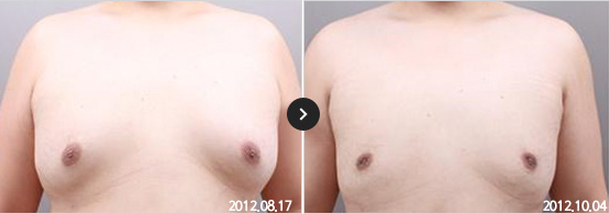 365mc BEFORE & AFTER
